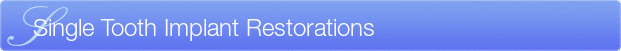 Dentist Laurel Single Tooth Implant Restorations